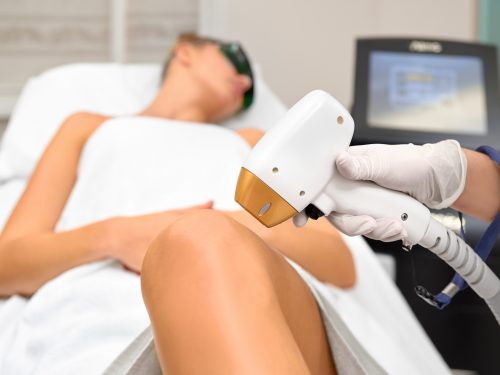 Depilación láser Valencia