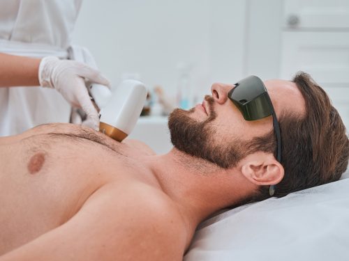 Depilación láser valencia