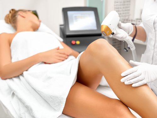 Depilación láser Valencia