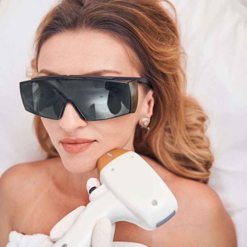 DEPILACION-LASER-FACIAL-valencia