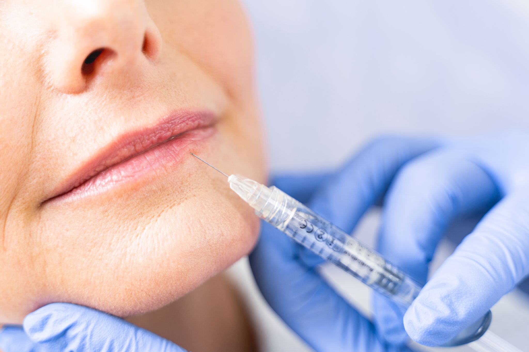  Aaumentar los labios de forma natural