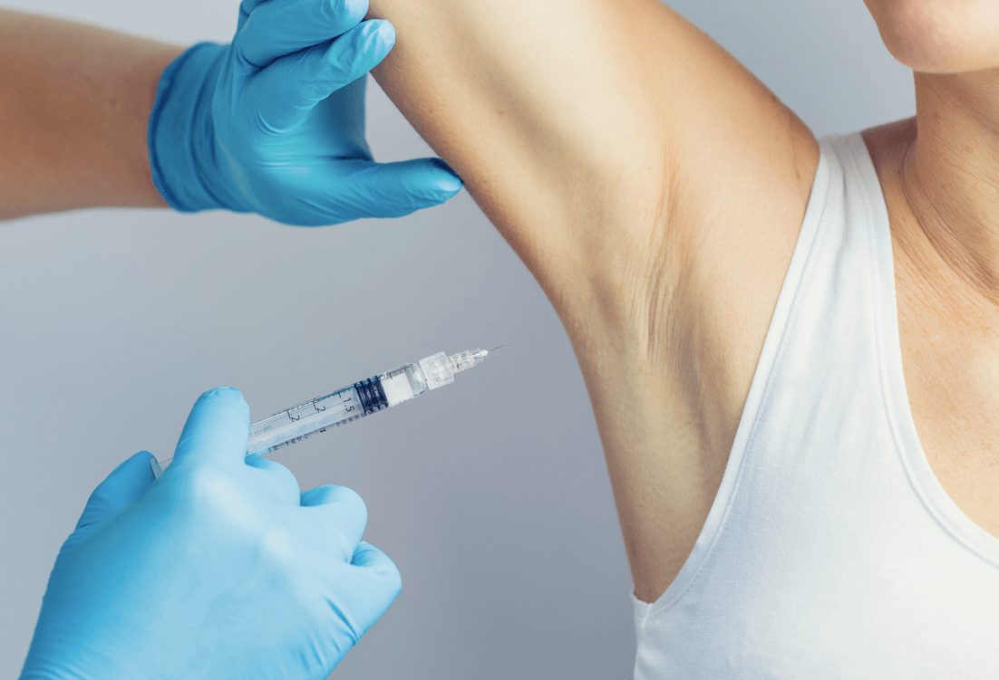 Exceso de sudoración en las axilas o Hiperhidrosis.