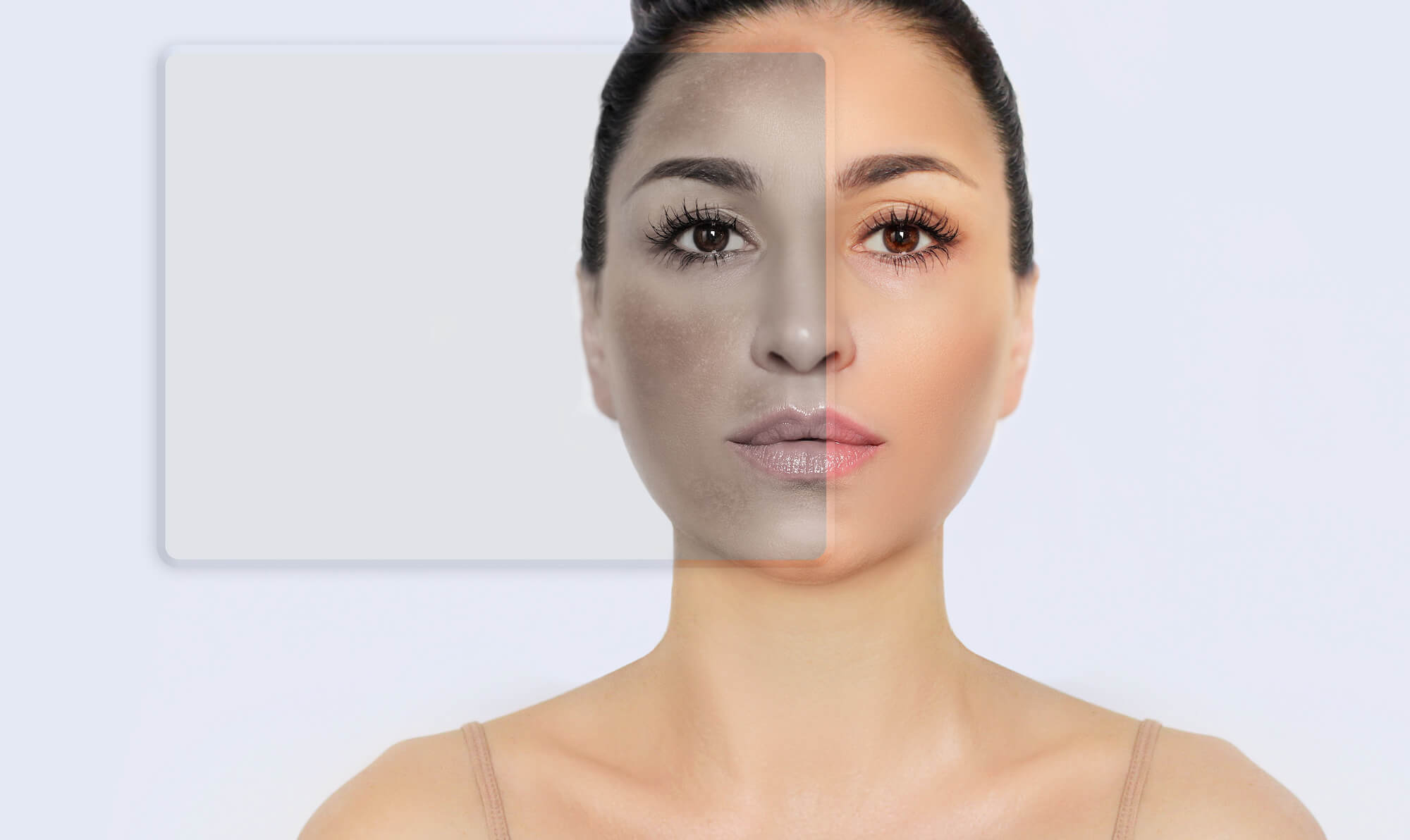 Melasma y las manchas faciales