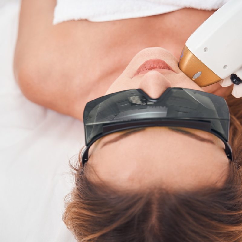 vello facial mujeres causa