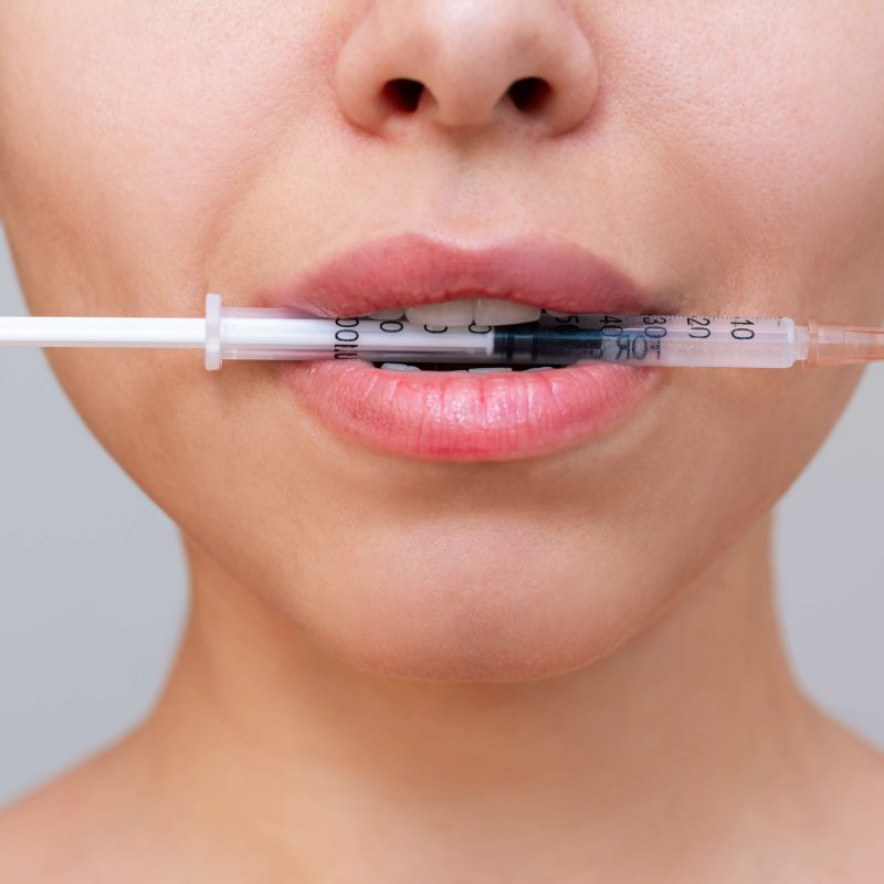 aumento labios valencia ofertas