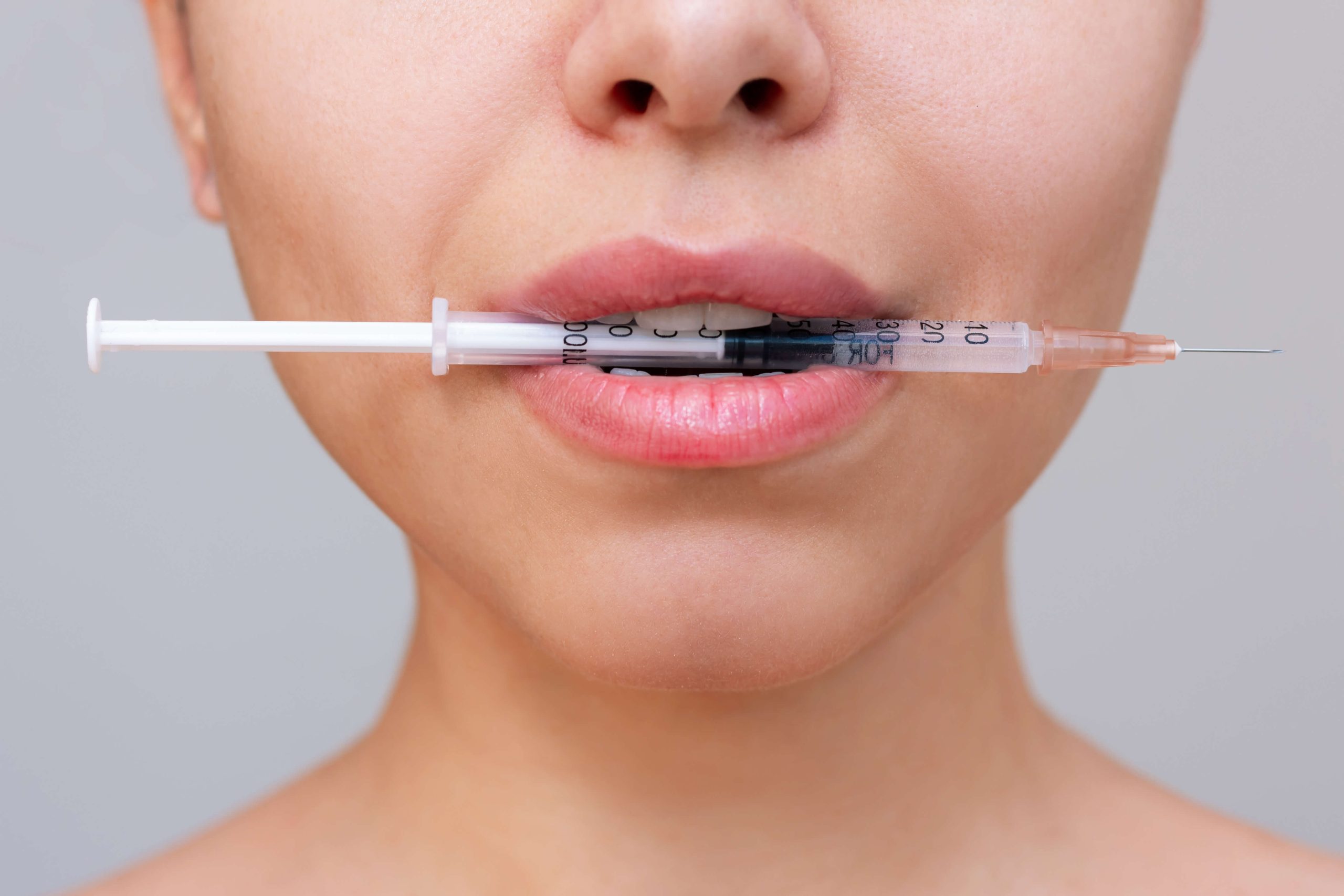 Tendencias en Aumento de Labios con Ácido Hialurónico en 2025